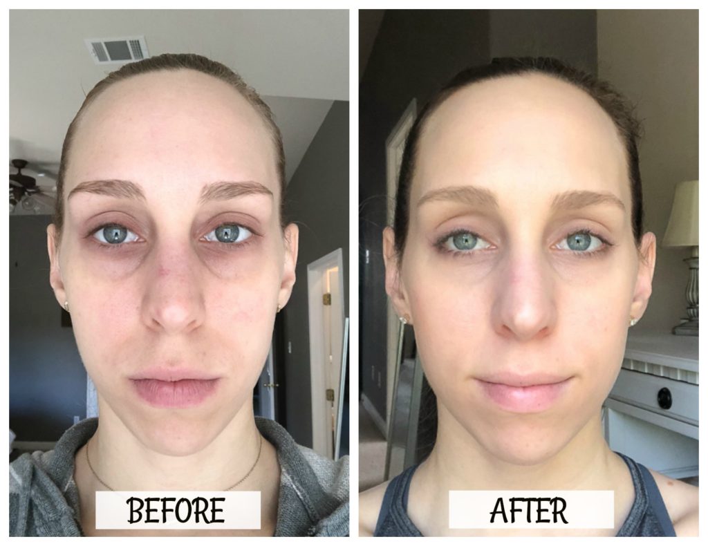 Rodan + Fields Results